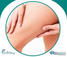 Slider image (5) Medilaser Plastic Surgery Clinic